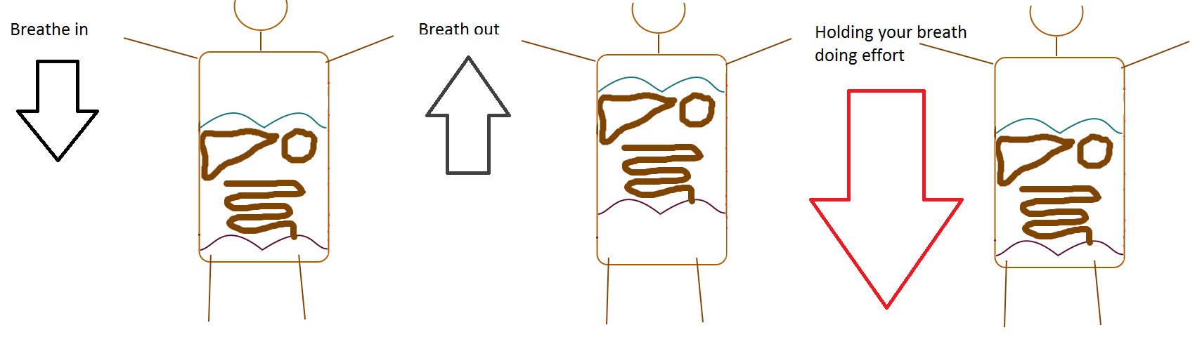 Women's health & obstetric prolapse causes