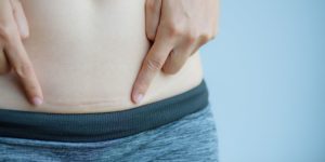 C-section recovery & Scar Massage